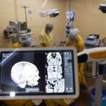 Un neuronavegador asistió una cirugía cerebral de alta complejidad en el Pirovano